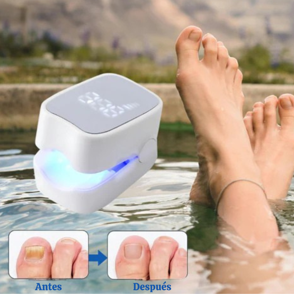 NailCure Pro- Dispositivo láser para hongos en las uñas