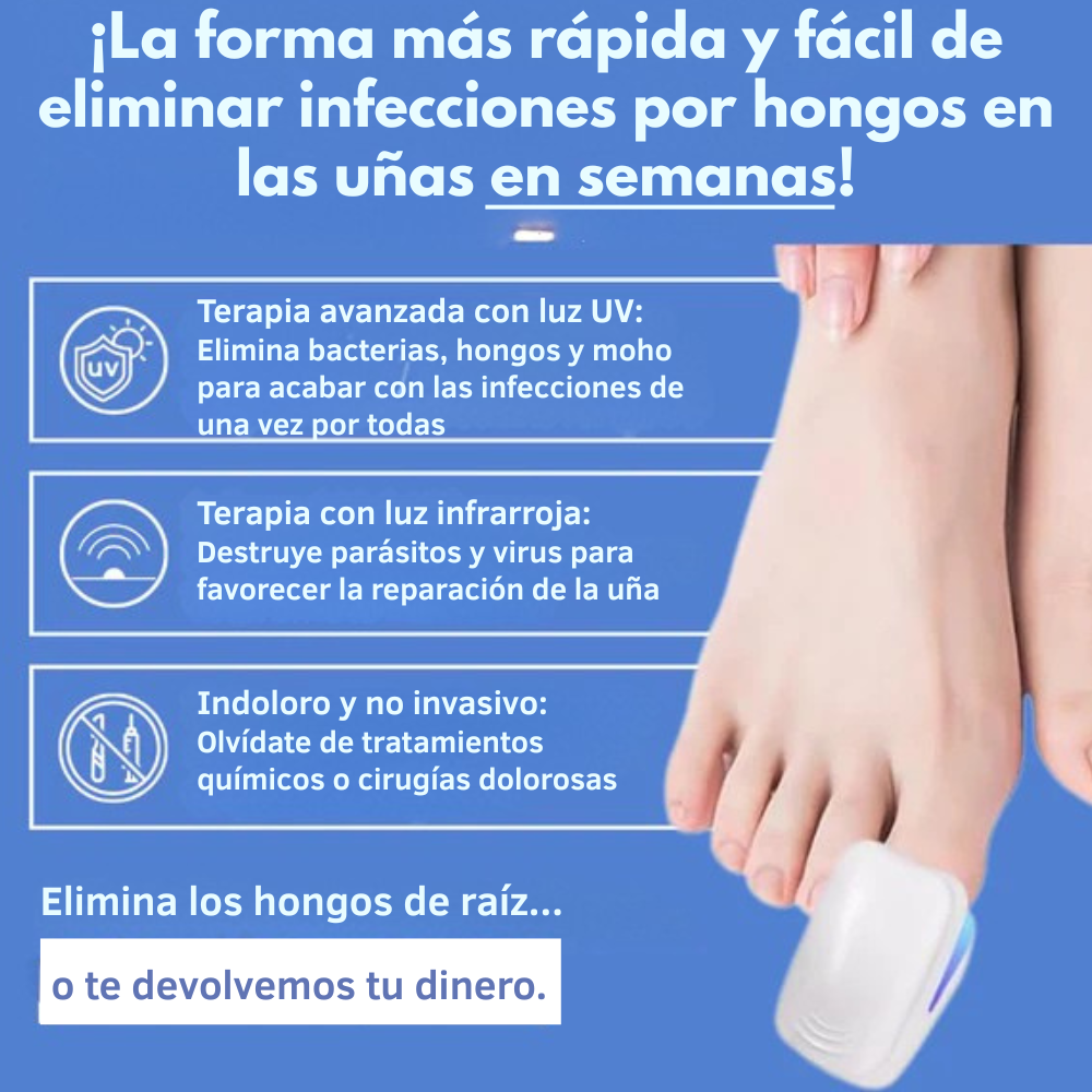 NailCure Pro- Dispositivo láser para hongos en las uñas