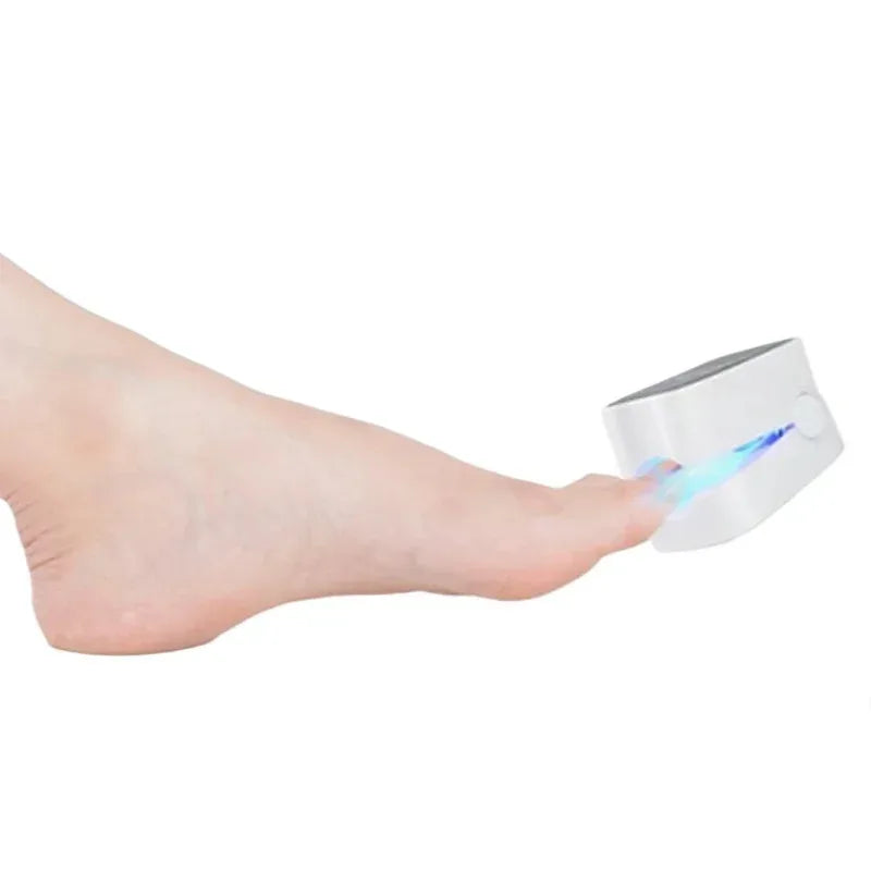 NailCure Pro- Dispositivo láser para hongos en las uñas